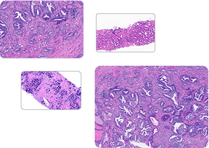 Prostate IHC Explorer: Pathology Image Library