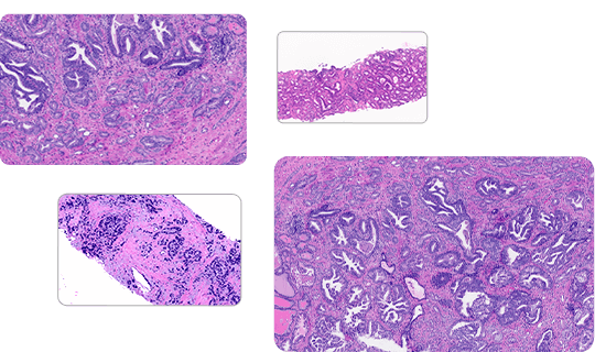 Pathology Image Library