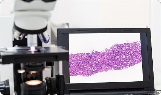 Test for PTEN Deficiency