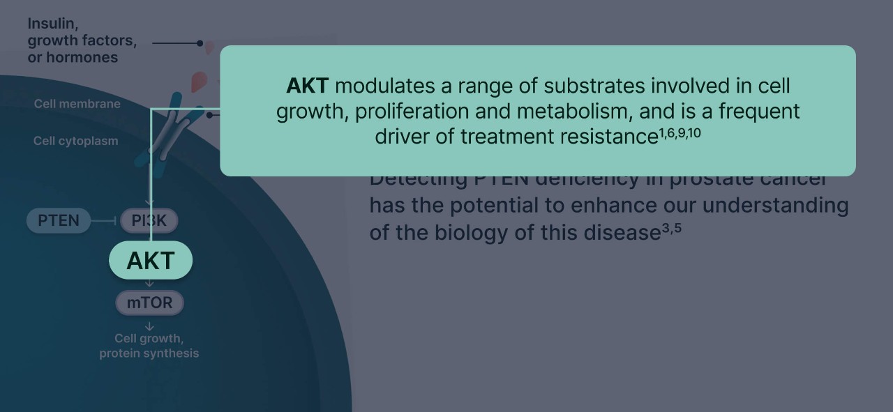 PI3K/AKT and AR Signaling in PTEN-Deficient Tumors Illustration 3